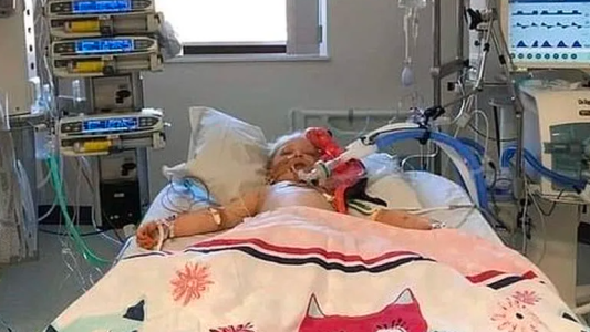 Una madre compartió la foto de su hija luchando contra la enfermedad de Kawasaki