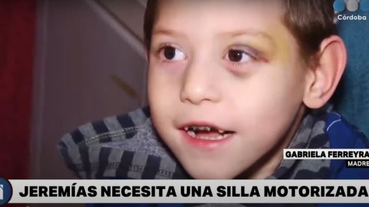 Solidaridad: Jeremías necesita una silla motorizada por su enfermedad