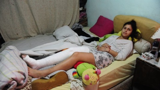 Habló la chica a la que le quebraron la pierna para robarle el celular en Glew