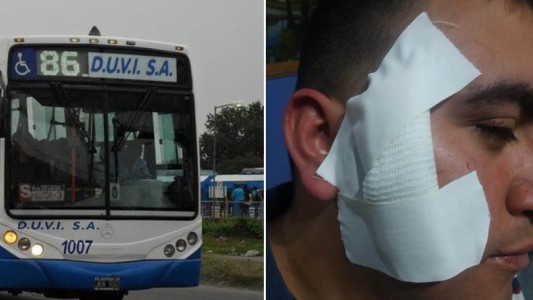 Colectivero tuvo coronavirus, se repuso, volvió a trabajar y lo apuñalaron para robarle