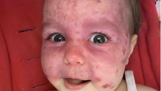 El calvario de Ariya: la beba tiene una enfermedad rara y se dificulta su atención por el coronavirus