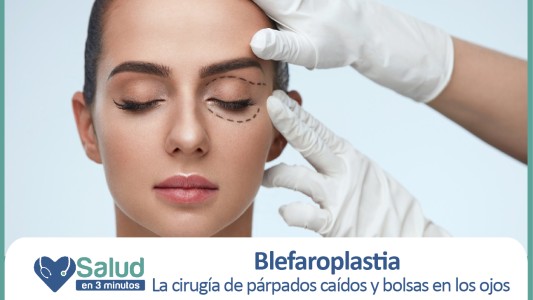 Párpados caídos, un problema que tiene solución