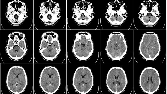 Era fanático de las plantas, estaba arreglando su jardín y una infección de la tierra le disolvió el cerebro