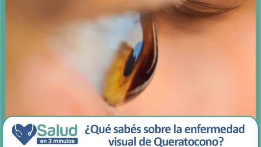 Queratocono: una patología que tiene tratamiento