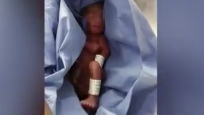 Video: dieron muerto a un bebé por error y estuvo 6 horas en la morgue
