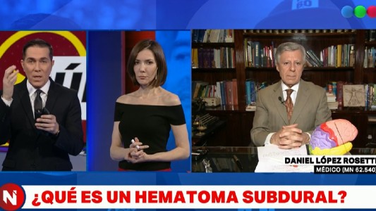 ¿Qué es el hematoma subdural del que será operado Maradona?