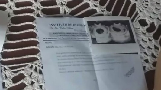 "Hace un mes tengo a mi bebé sin vida en mi panza": no puede pagar los $25 mil de la operación