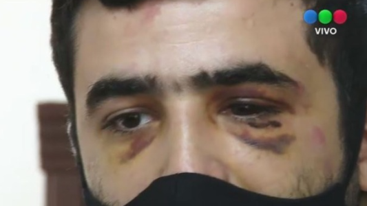 Detienen a cinco empleados municipales por agresiones a un comerciante y a un niño