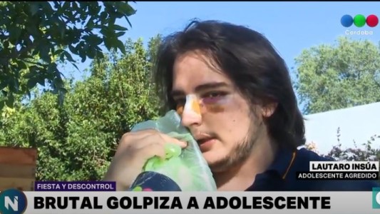 VIDEO: "Uno me partió el tabique y otro me pateó en el piso", dijo el joven golpeado en una fiesta