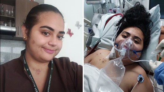 "Tuve que aprender de nuevo a hablar, escribir y caminar": el drama de una médica con secuelas tras contagiarse coronavirus