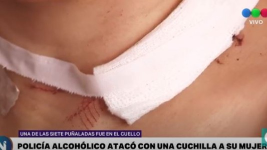 "Sacó un cuchillo...me agarró del cuello. Él sabía lo que hacía", el valiente testimonio de una víctima de violencia de género.
