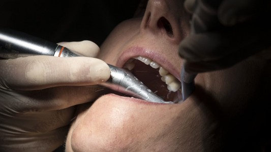 Acusan a un dentista de romper los dientes de pacientes para realizarles costosos procedimientos