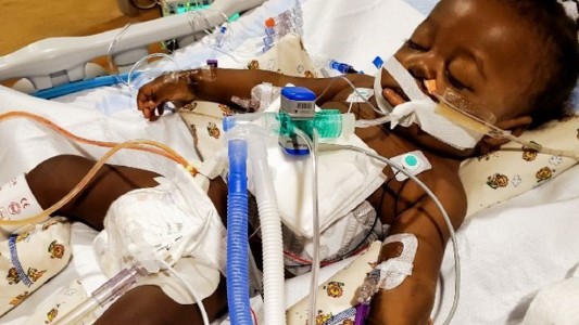 El "bebé milagro" que superó el coronavirus y un trasplante de hígado