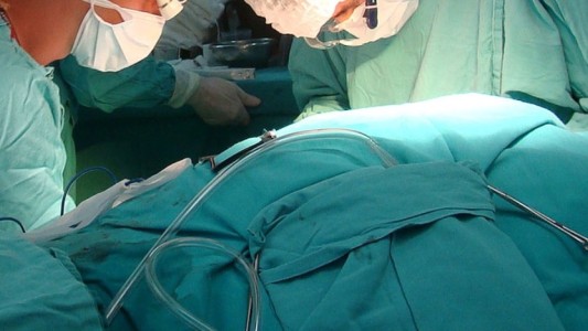 Trasplantes de córneas: tras un año de espera por la pandemia, dos pacientes recuperan la visión