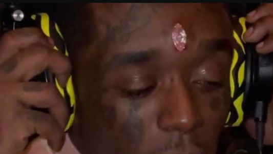 "La belleza es dolor": rapero se injertó en la frente un diamante de 24 millones de dólares