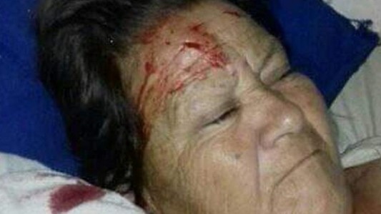 Santiago del Estero: estaba internada en un hospital y le cayó un ventilador de techo en la cara