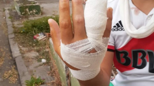 Viedma: un joven se metió en una pelea de perros y perdió una falange