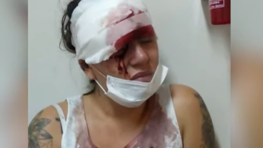 El ex de su amiga rompió la perimetral, quiso defenderla y la hirió gravemente