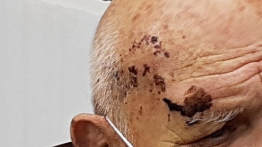 "No me arrepiento: acá el ladrón vive y el que labura muere", dijo el jubilado arrastrado por un auto