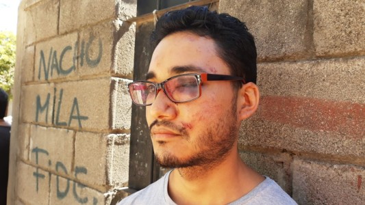 Inseguridad en Córdoba: Le desfiguraron la cara a patadas porque no le pudieron robar