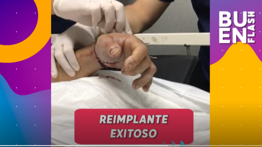#BuenFlash: reimplante de mano exitoso en Córdoba y otras noticias importantes del día