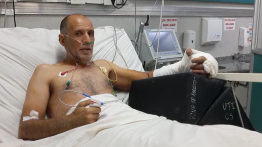Habló el hombre al que le implantaron una mano en el Hospital de Urgencias