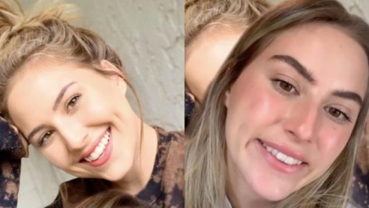 Video: la chica que contó como una inyección de bótox le arruinó la sonrisa
