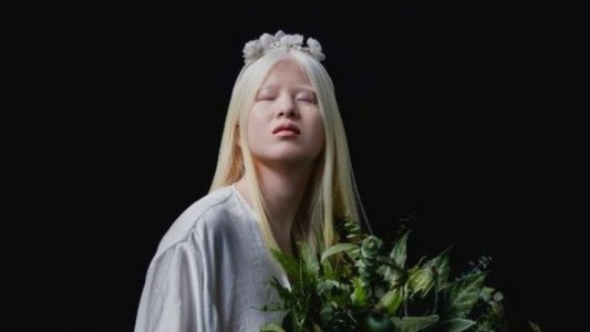 Se convirtió en modelo internacional tras ser abandonada de bebé por ser albina