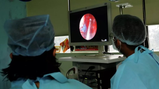 Alerta en Brasil por el primer caso de "hongo negro" en Brasil en un paciente con covid