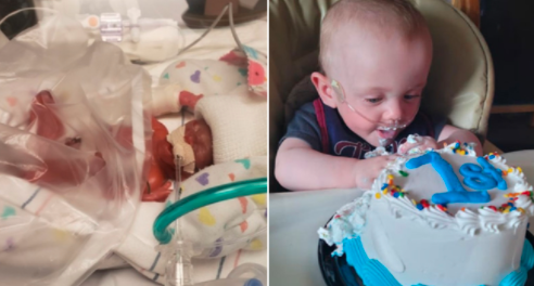 Cumplió un año el bebé más prematuro del mundo: los médicos le daban cero chance de vida