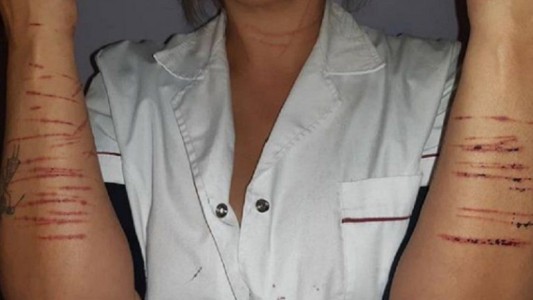 Un hombre se subió a un auto e intentó violar a la conductora: le cortó todo el cuerpo