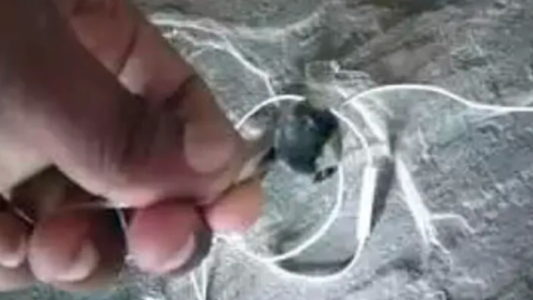 Murió un hombre al explotarle los auriculares bluetooth que llevaba puestos