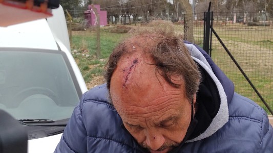 Un cliente lo atacó con un caño porque le vendió dos barriletes fallados