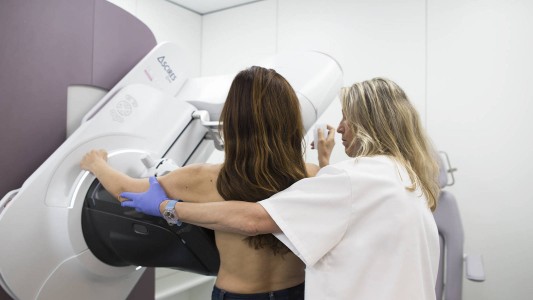 Una bioingeniera desarrolló un algoritmo para detectar el cáncer de mama