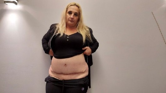 Tuvo que vender su camioneta para pagar una cirugía estética y ahora vive un infierno