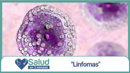 Linfoma: Un cáncer de la Sangre