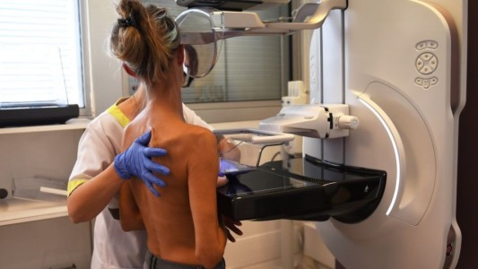 Cáncer de mama: durante la pandemia, 7 de cada 10 mujeres no hicieron la visita médica