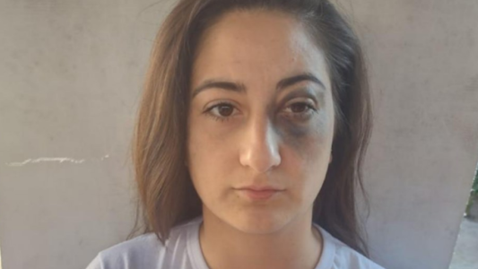 Policía a juicio por golpear a una motociclista en un control vehicular