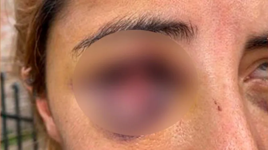 Le dio una brutal paliza a su ex, creyó que la había matado y la escondió abajo de la cama: la salvó su hija de 12 años