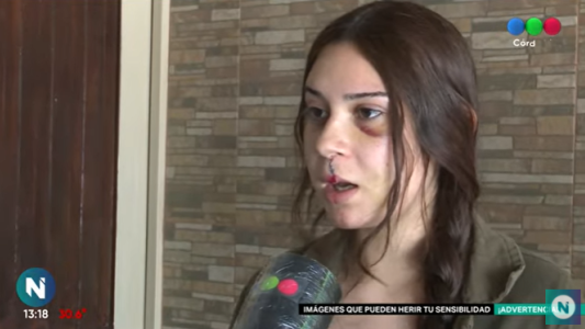 El desgarrador testimonio de la joven agredida por la policía