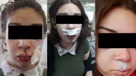 Denuncia de grave golpiza a manos de policías fue desestimada por la justicia