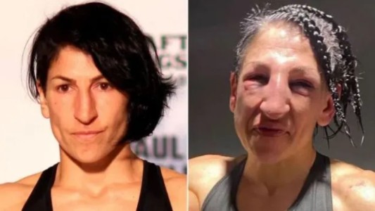 La foto del antes y el después: boxeadora recibió 236 golpes