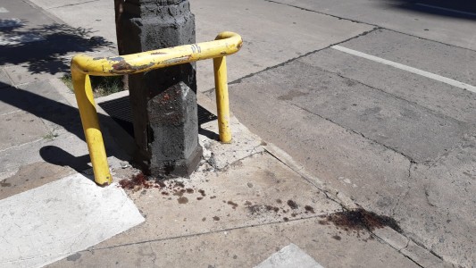 "Me cuesta asimilarlo, no caigo del todo" el relato de Milagros, la chica amputada tras un choque