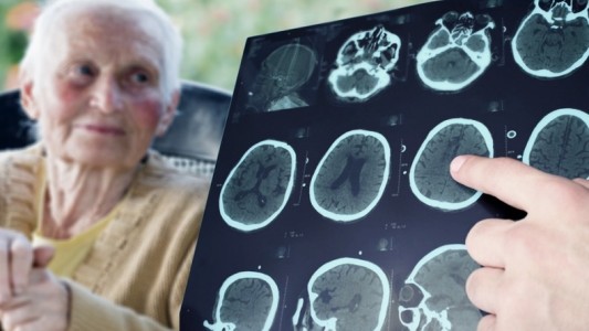 Un software de desarrollo argentino podría diagnosticar de forma precoz el Alzheimer