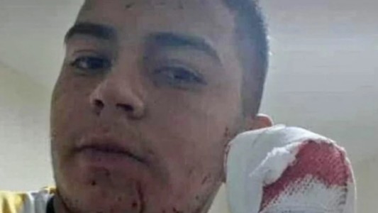 Brutal asalto con un machete a un repartidor de comida: perdió cuatro dedos