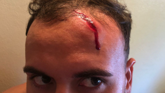 Mapuches atacaron con boleadoras y piedras a turistas que intentaron esquivar un corte en la ruta