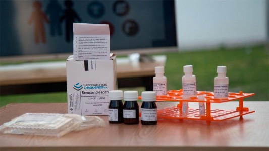 La Anmat registró un nuevo kit de producción local para detectar coronavirus