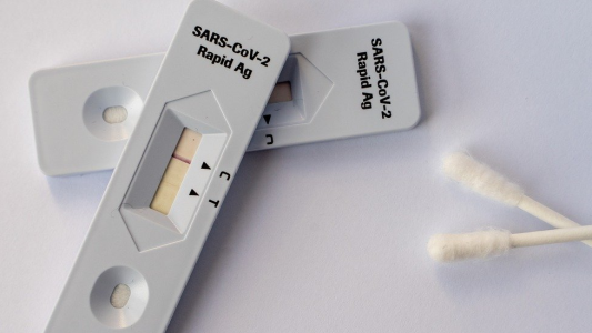 Autotest frenados: deberán esperar hasta febrero