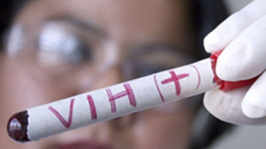 Prueban en humanos una vacuna contra el VIH