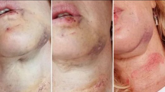 Alarma por un hombre que agrede a mujeres en la calle en Belgrano R.